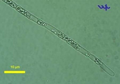 Aphanizomenon ovalisporum