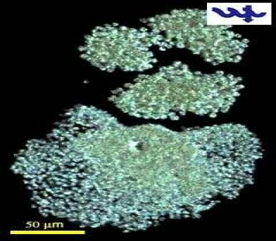 Microcystis flos-aquae and Microcystis aeruginosa