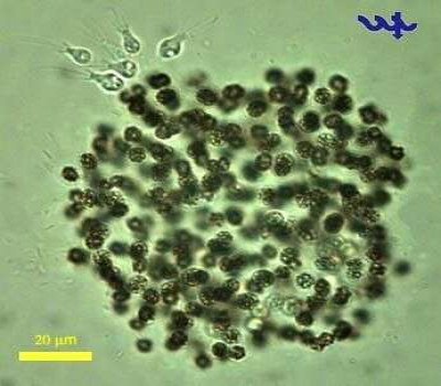 Microcystis flos-aquae