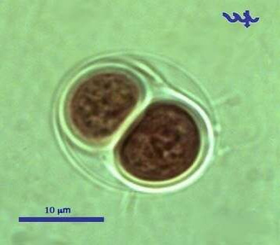 Observations of Chroococcus turgidus in Lake Kinneret