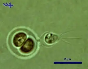 Chroococcus turgidus