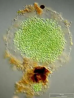 Sample Taken From Hegne Moor Pond Near Constance