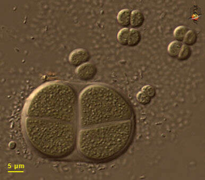 <em>Chroococcus</em>