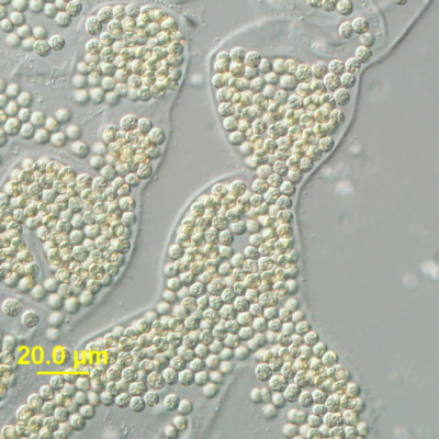 Microcystis wesenbergii Light Micrograph