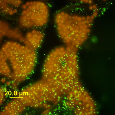 <em>Microcystis wesenbergii</em> Epifluorescence Microscopy