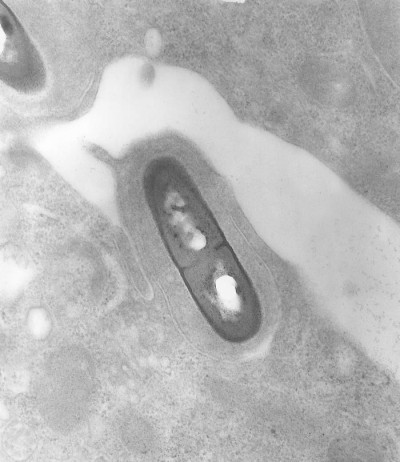 Electron Micrograph of a Listeria Bacterium