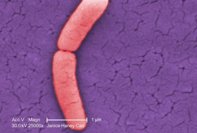 A Single Gram-Negative <em>Salmonella typhimurium </em>Bacterium