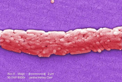 Scanning Electron Micrograph of <em>Salmonella typhimurium</em>