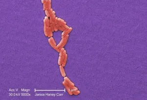 Numbers of Clustered Gram-Negative Salmonella typhimurium Bacteria