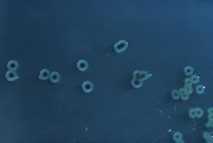 Hydrogen Sulfide Producing Salmonella typhimurium on HE Agar