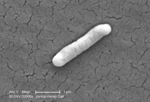 A Single Gram-Negative Salmonella typhimurium Bacterium