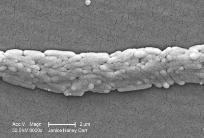 Scanning Electron Micrograph of Salmonella typhimurium Bacteria