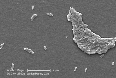 Scanning Electron Micrograph of <em>Salmonella typhimurium</em>