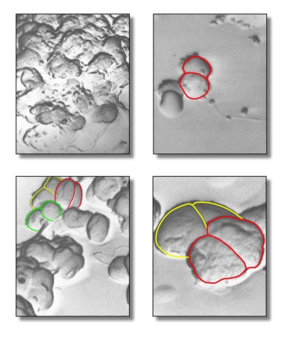 Four Views of <em>Neisseria gonorrhoeae</em>