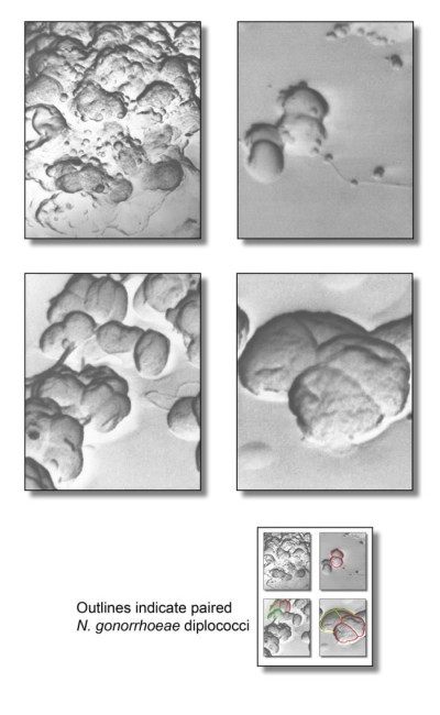 Four Views of Gram-Negative <em>Neisseria gonorrhoeae </em>Bacteria