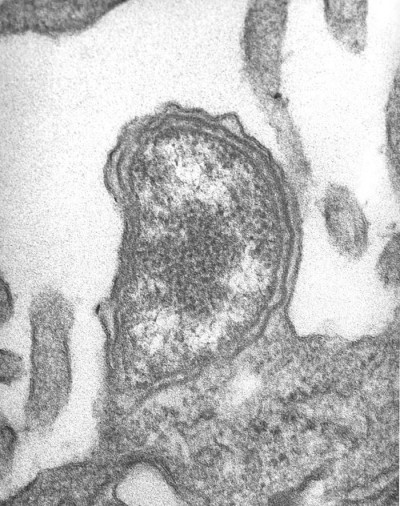 Image of <em>Orientia tsutsugamushi</em>