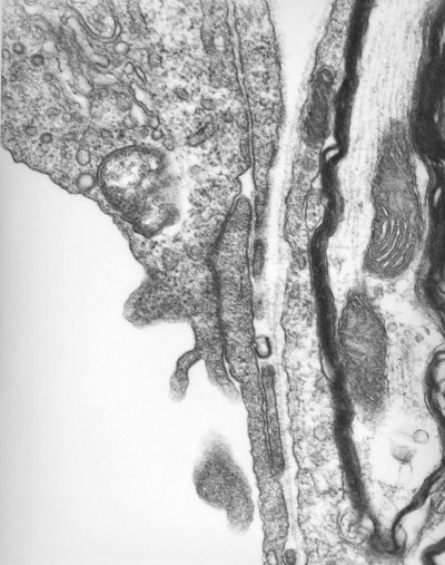 Brain Capillary of Mouse Infected Intravenously with Orientia tsutsugamushi