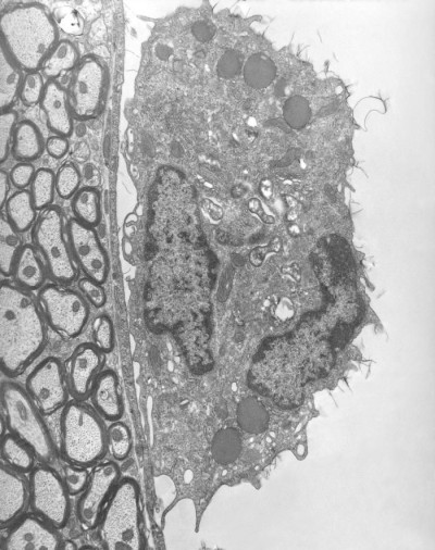 Image of <em>Orientia tsutsugamushi</em>