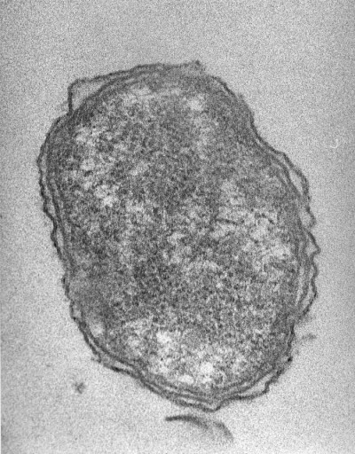 Transmission Electron Micrograph of Orientia tsutsugamushi