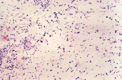 Image of Peptostreptococcus