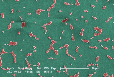 Image of Acinetobacter baumannii