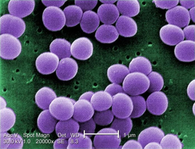 A Strain of Staphylococcus aureus Bacteria