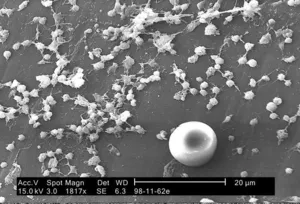 Staphylococcus aureus