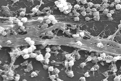 Electron Micrograph of Staphylococcus