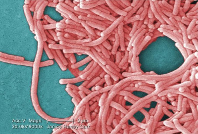 Image of Legionella