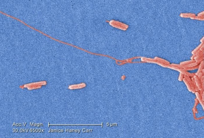 A Scanning Electron Micrograph of Legionella