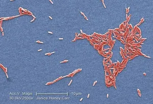 Legionella pneumophila