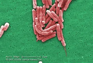 A Number of Gram-Negative Legionella pneumophila Bacteria
