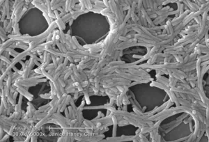  Legionella pneumophila Bacteria