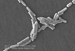 Legionella pneumophila 