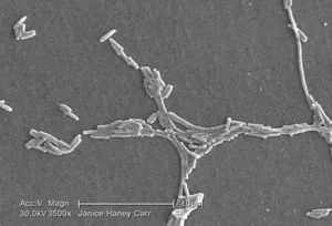 Legionella pneumophila