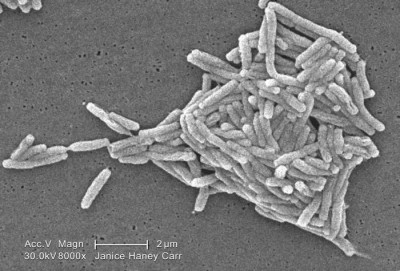 Image of Legionella pneumophila