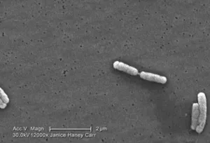 Legionella pneumophila 