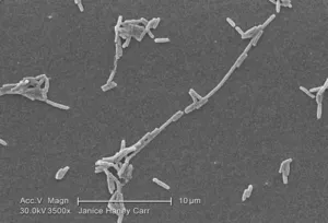 A Scattered Group of Gram-Negative Legionella pneumophila Bacteria