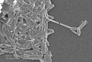 A Large Grouping of Gram-Negative Legionella pneumophila Bacteria