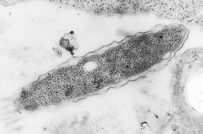 <em>Legionella pneumophila</em>