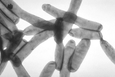 Transmission Electron Micrograph of Legionella pneumophila