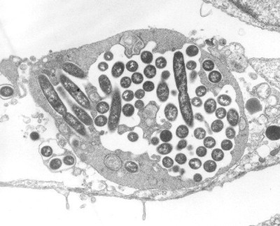 Image of <em>Legionella pneumophila</em>