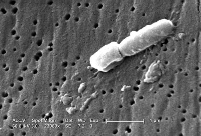 Image of <em>Klebsiella pneumoniae</em>