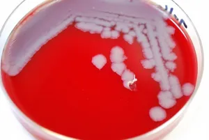 Bacillus anthracis Bacterial Colonies