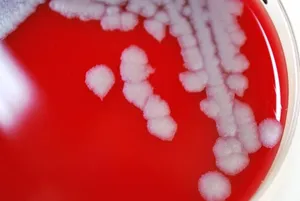 Bacillus anthracis Bacterial Colonies