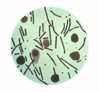 <em>Bacillus anthracis</em>