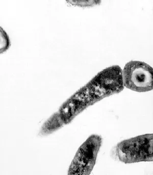 Bacillus anthracis