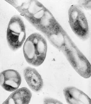 Bacillus anthracis