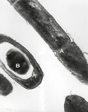 Bacillus anthracis