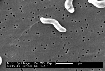 Scanning Electron Micrograph of <em>Campylobacter jejuni</em>